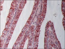 单克隆抗 β-微管蛋白 I 小鼠抗 clone SAP.4G5, ascites fluid