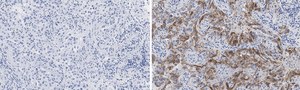 Anti-Integrin αVβ8 Antibody, clone EM13309 , ZooMAb® Rabbit Monoclonal recombinant, expressed in HEK 293 cells