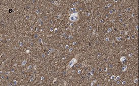 Anti-β-Tubulin III Antibody, clone 5H16, ZooMAb® Rabbit Monoclonal recombinant, expressed in HEK 293 cells