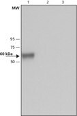 Anti-Glucocerebrosidase (C-terminal) antibody produced in rabbit ~1 mg/mL, affinity isolated antibody, buffered aqueous solution
