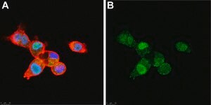 Anti-SNAI1 Antibody, clone 1F16 ZooMAb® Rabbit Monoclonal recombinant, expressed in HEK 293 cells