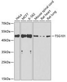 Anti-TSG101 antibody produced in rabbit