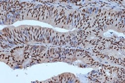 Anti-BUB3 antibody produced in rabbit