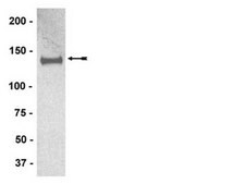 Anti-IRS1 Antibody, clone AW58, rabbit monoclonal culture supernatant, clone AW58, Upstate®