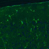 Monoclonal Anti-GLUL antibody produced in mouse Prestige Antibodies® Powered by Atlas Antibodies, clone CL3013, purified immunoglobulin, buffered aqueous glycerol solution
