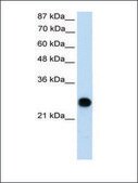 Anti-VDAC2 antibody produced in rabbit affinity isolated antibody