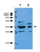 Anti-VDAC2 antibody produced in rabbit affinity isolated antibody