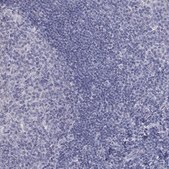Anti-PTH1R antibody produced in rabbit Prestige Antibodies® Powered by Atlas Antibodies, affinity isolated antibody, buffered aqueous glycerol solution