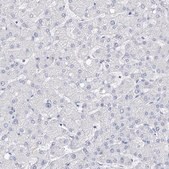 Anti-FLG antibody produced in rabbit Prestige Antibodies® Powered by Atlas Antibodies, affinity isolated antibody, buffered aqueous glycerol solution, ab2