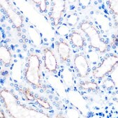 Anti-LAMP2 antibody produced in rabbit