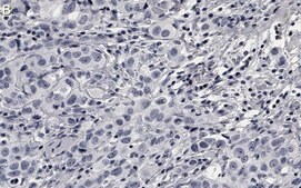 Anti-Phospho-AKT1-(Ser473) Antibody, clone 1O14 ZooMAb® Rabbit Monoclonal recombinant, expressed in HEK 293 cells