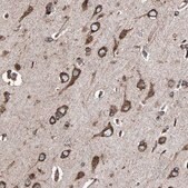 Anti-HSP90B1 antibody produced in rabbit Prestige Antibodies® Powered by Atlas Antibodies, affinity isolated antibody, buffered aqueous glycerol solution