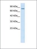 Anti-KCNN3 (AB1) antibody produced in rabbit affinity isolated antibody