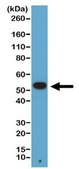 Anti-alpha-Tubulin Antibody, clone RM113 clone RM113, from rabbit