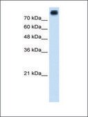 Anti-CDH3 antibody produced in rabbit IgG fraction of antiserum