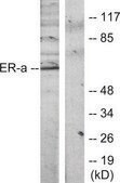 Anti-Estrogen Receptor-α antibody produced in rabbit affinity isolated antibody