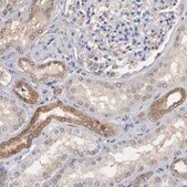 Anti-MIF antibody produced in rabbit Prestige Antibodies® Powered by Atlas Antibodies, affinity isolated antibody, buffered aqueous glycerol solution