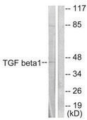 抗 TGFβ1 兔抗 affinity isolated antibody