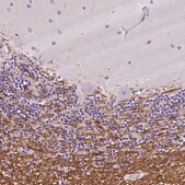 Anti-SIRT2 antibody produced in rabbit Prestige Antibodies® Powered by Atlas Antibodies, affinity isolated antibody, buffered aqueous glycerol solution