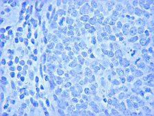 抗-Ki-67抗体 Chemicon®, from rabbit