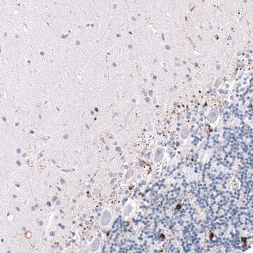 Monoclonal Anti-CRYAB antibody produced in mouse Prestige Antibodies® Powered by Atlas Antibodies, clone CL10765, purified antibody (Protein A)