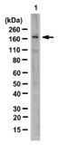 Anti-JHDM1B Antibody from rabbit, purified by affinity chromatography