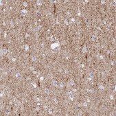 Anti-SLC6A1 antibody produced in rabbit Prestige Antibodies® Powered by Atlas Antibodies, affinity isolated antibody, buffered aqueous glycerol solution