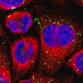 Anti-STK3 antibody produced in rabbit Prestige Antibodies® Powered by Atlas Antibodies, affinity isolated antibody, buffered aqueous glycerol solution