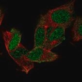 Anti-MSI1 antibody produced in rabbit Prestige Antibodies® Powered by Atlas Antibodies, affinity isolated antibody, buffered aqueous glycerol solution