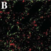 抗-聚唾液酸-NCAM抗体，克隆2-2B ascites fluid, clone 2-2B, Chemicon®