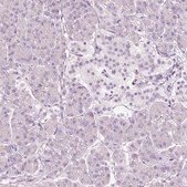 Anti-VCAM1 antibody produced in rabbit Prestige Antibodies® Powered by Atlas Antibodies, affinity isolated antibody, buffered aqueous glycerol solution