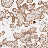 Anti-MYO10 antibody produced in rabbit Prestige Antibodies® Powered by Atlas Antibodies, affinity isolated antibody, buffered aqueous glycerol solution