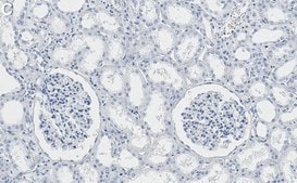 Anti-PKR Antibody, clone 2H14 ZooMAb® Rabbit Monoclonal recombinant, expressed in HEK 293 cells