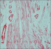 Anti-Mouse IgG (whole molecule)−Alkaline Phosphatase antibody produced in rabbit affinity isolated antibody, buffered aqueous glycerol solution