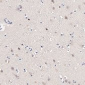 Anti-TNFRSF13C antibody produced in rabbit Prestige Antibodies® Powered by Atlas Antibodies, affinity isolated antibody, buffered aqueous glycerol solution