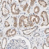 Anti-CLPP antibody produced in rabbit Prestige Antibodies® Powered by Atlas Antibodies, affinity isolated antibody, buffered aqueous glycerol solution