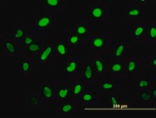 ANTI-HMGB2 antibody produced in mouse clone 3D2, purified immunoglobulin, buffered aqueous solution