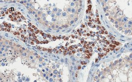 Anti-OCT4 Antibody, clone 4N8, ZooMAb® Rabbit Monoclonal recombinant, expressed in HEK 293 cells