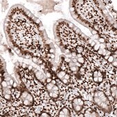 Monoclonal Anti-HIST1H2AG antibody produced in mouse Prestige Antibodies® Powered by Atlas Antibodies, clone CL5039, purified immunoglobulin, buffered aqueous glycerol solution