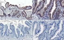 Anti-AMPK α1 Antibody Upstate®, from rabbit
