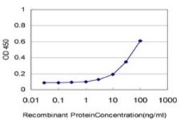 Monoclonal Anti-IL18BP antibody produced in mouse clone 2A9, purified immunoglobulin, buffered aqueous solution