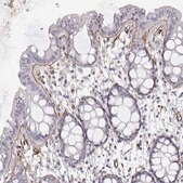 Monoclonal Anti-LAMC1 antibody produced in mouse Prestige Antibodies® Powered by Atlas Antibodies, clone CL3199, purified immunoglobulin, buffered aqueous glycerol solution