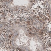 Monoclonal Anti-LAMB1 antibody produced in mouse Prestige Antibodies® Powered by Atlas Antibodies, clone CL2970, purified immunoglobulin, buffered aqueous glycerol solution