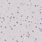 Anti-ACTL6B antibody produced in rabbit Prestige Antibodies® Powered by Atlas Antibodies, affinity isolated antibody, buffered aqueous glycerol solution