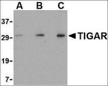 抗-TIGAR (ab1) 兔抗 affinity isolated antibody, buffered aqueous solution