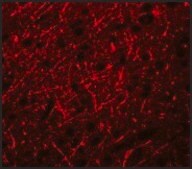 Anti-PRDM16 antibody produced in rabbit affinity isolated antibody