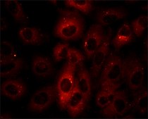 抗p62/SQSTM1 兔抗 ~1 mg/mL, affinity isolated antibody, buffered aqueous solution