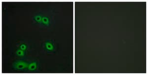 Anti-MUC1 antibody produced in rabbit affinity isolated antibody