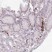 Anti-CSF3R antibody produced in rabbit Prestige Antibodies® Powered by Atlas Antibodies, affinity isolated antibody, buffered aqueous glycerol solution