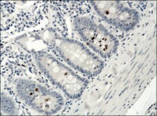 Anti-acetyl- &amp; phospho-Histone H3 (Ac-Lys9, pSer10) antibody produced in rabbit IgG fraction of antiserum, buffered aqueous solution